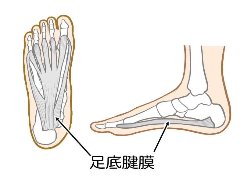 足底腱膜