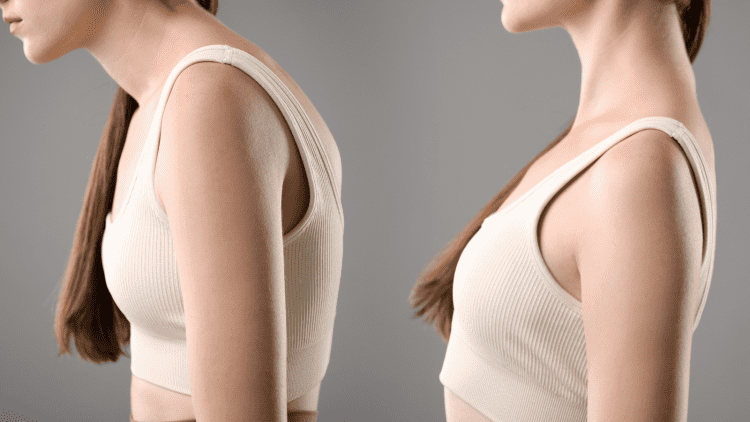 【驚くほど肩が軽くなる】巻き肩劇的改善ストレッチ｜理学療法士が根本原因から教える