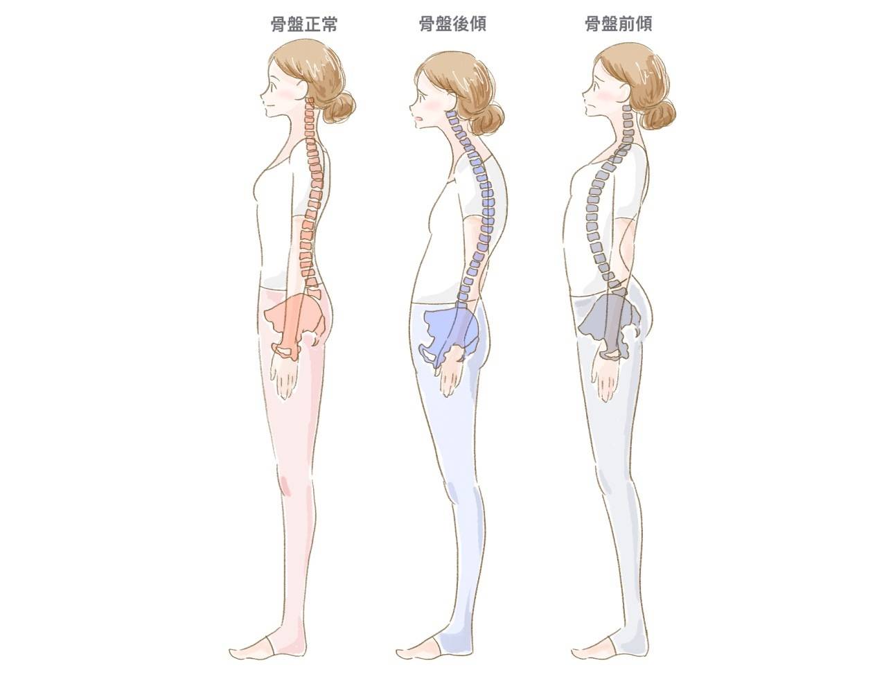 骨盤の姿勢