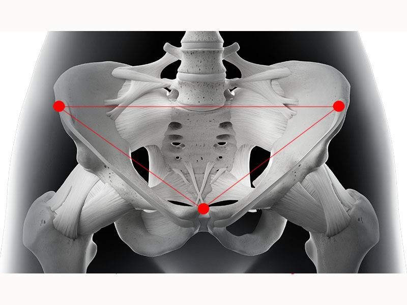 恥骨と上前腸骨棘を結んだ三角ライン