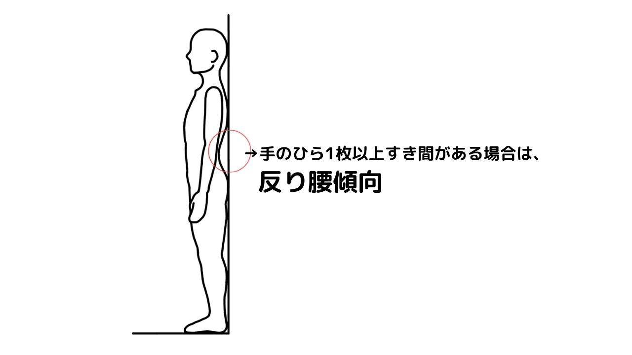 反り腰チェック