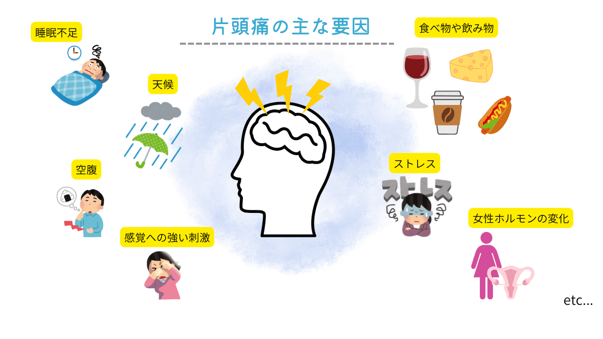 片頭痛の要因