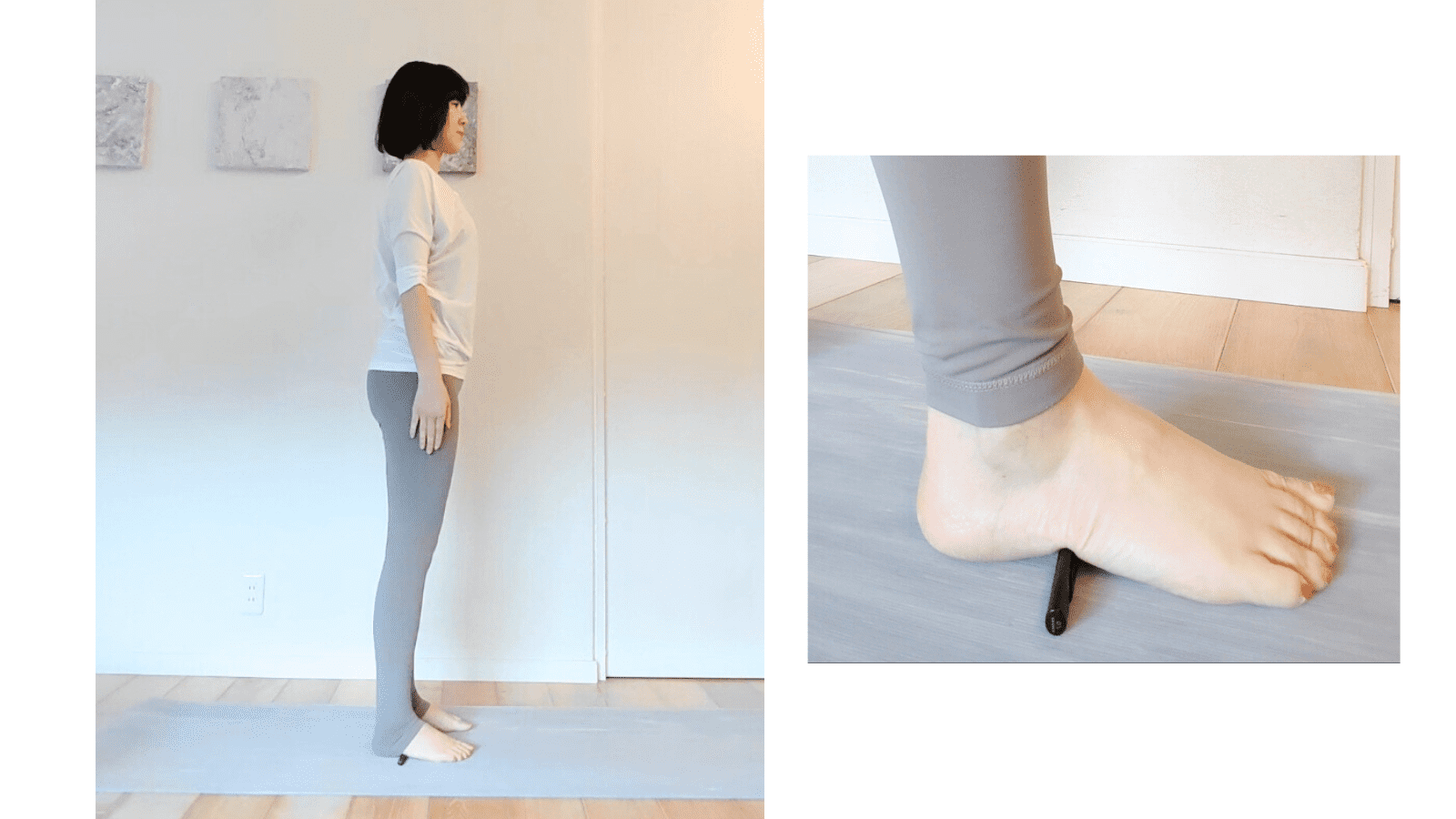 外側アーチケア