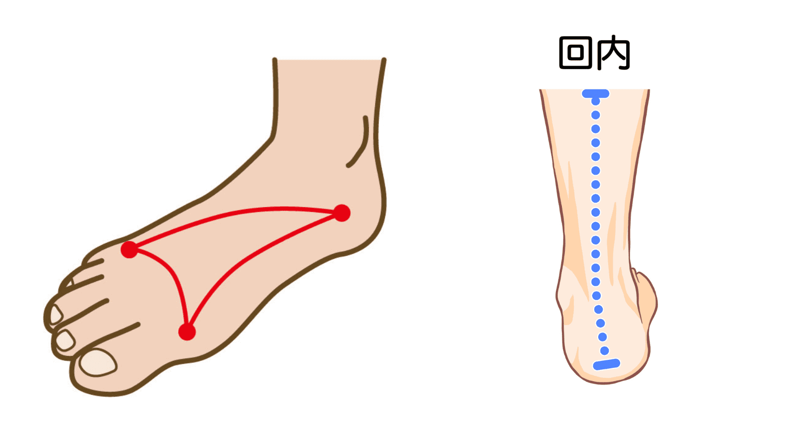 足のアーチ　回内