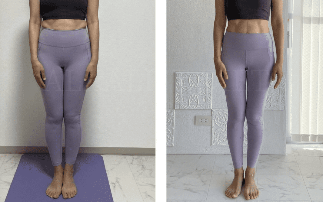 脚やせしたお客様の変化