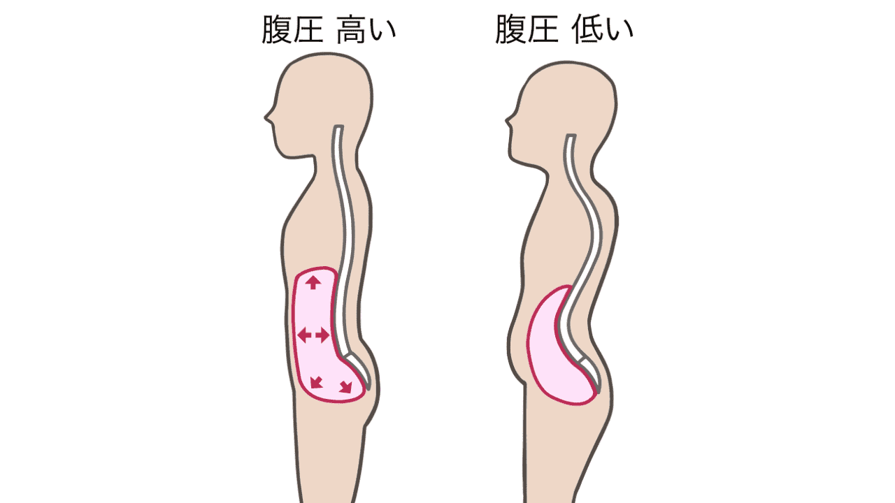 腹圧