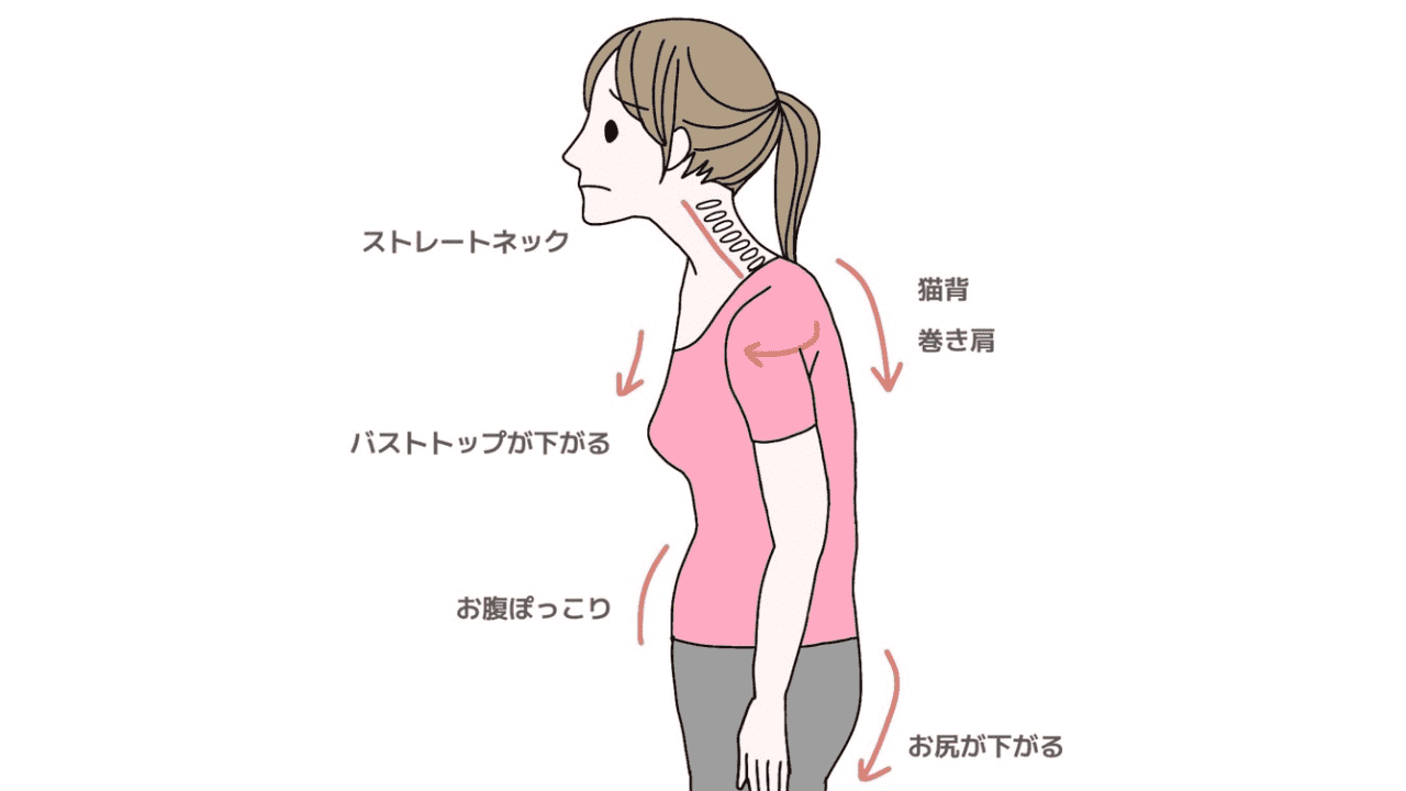 姿勢不良