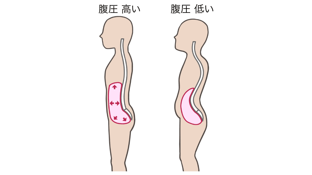 腹圧