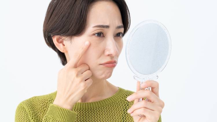 シミが増えてきた…40・50代が気をつけたい食習慣3選|管理栄養士が解説