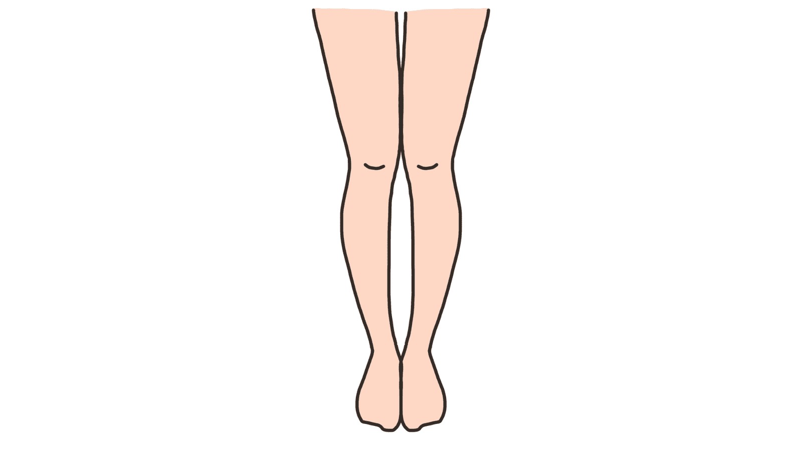 膝下O脚　XO脚　イラスト