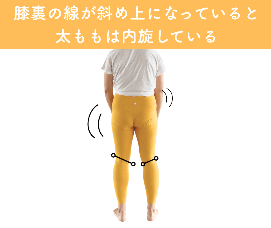 内股チェック