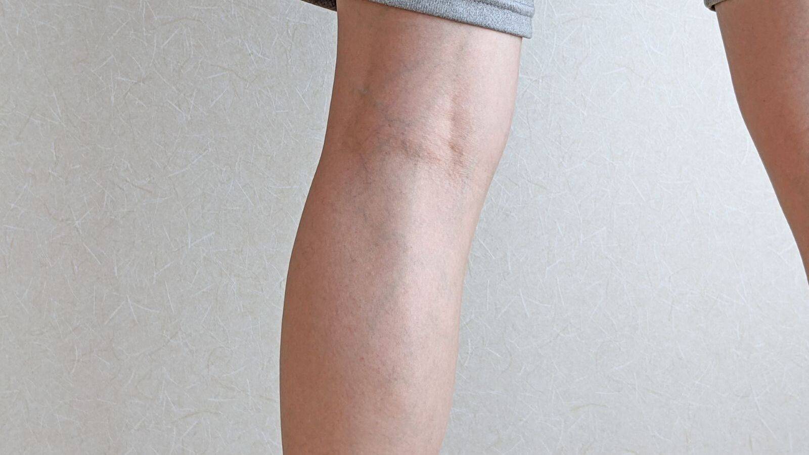  前屈できないのは膝裏の硬さが原因！？前屈がスルリとできるようになる膝裏ストレッチ 