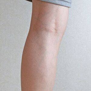 前屈できないのは膝裏の硬さが原因!?前屈がスルリとできるようになる膝裏ストレッチ