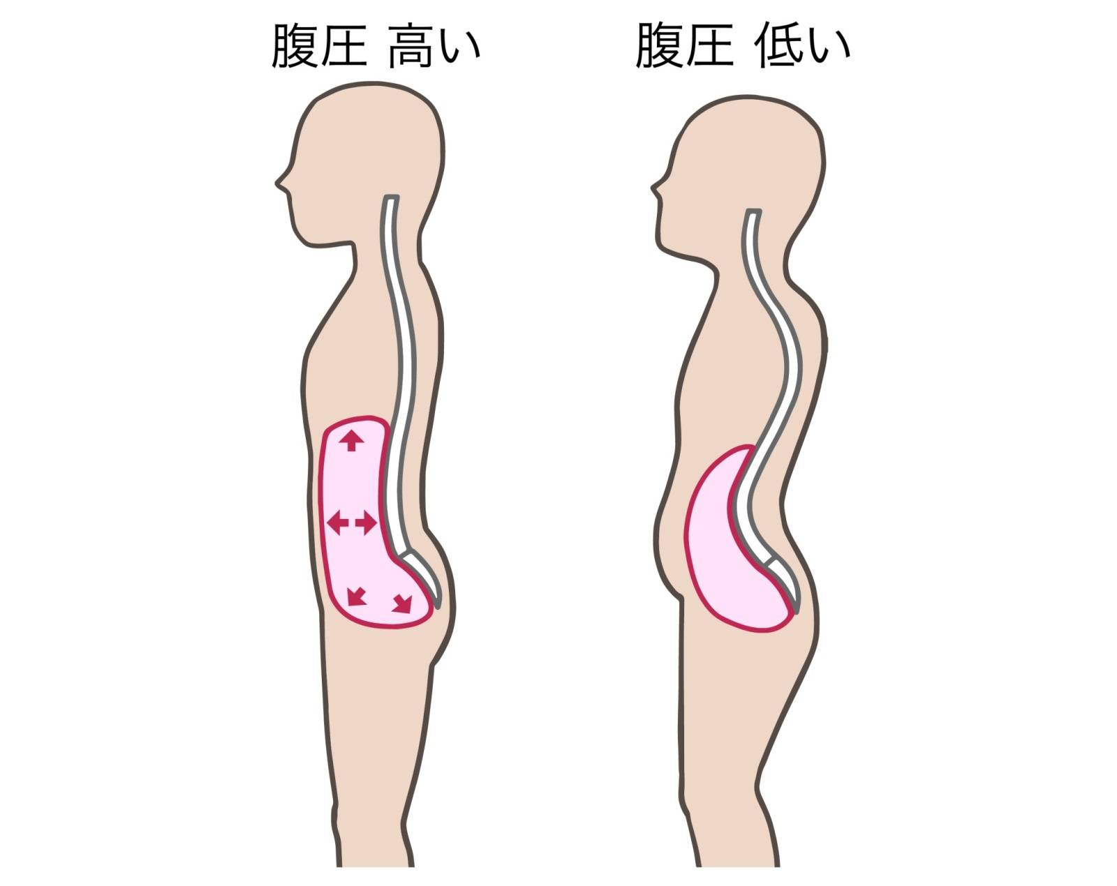 腹圧