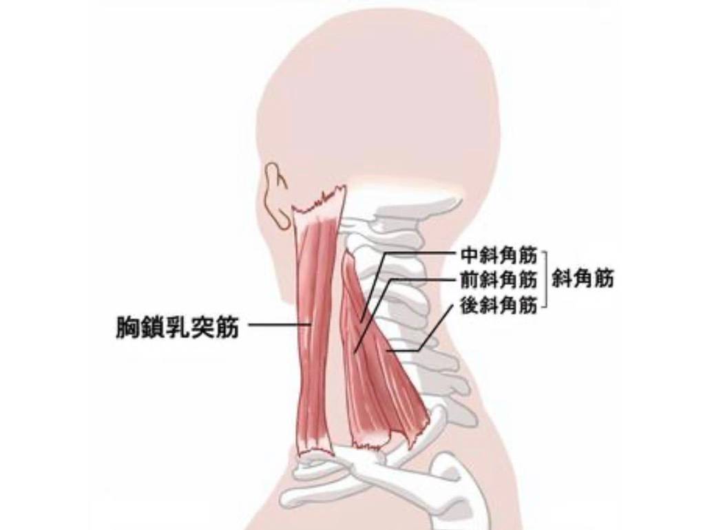 斜角筋
