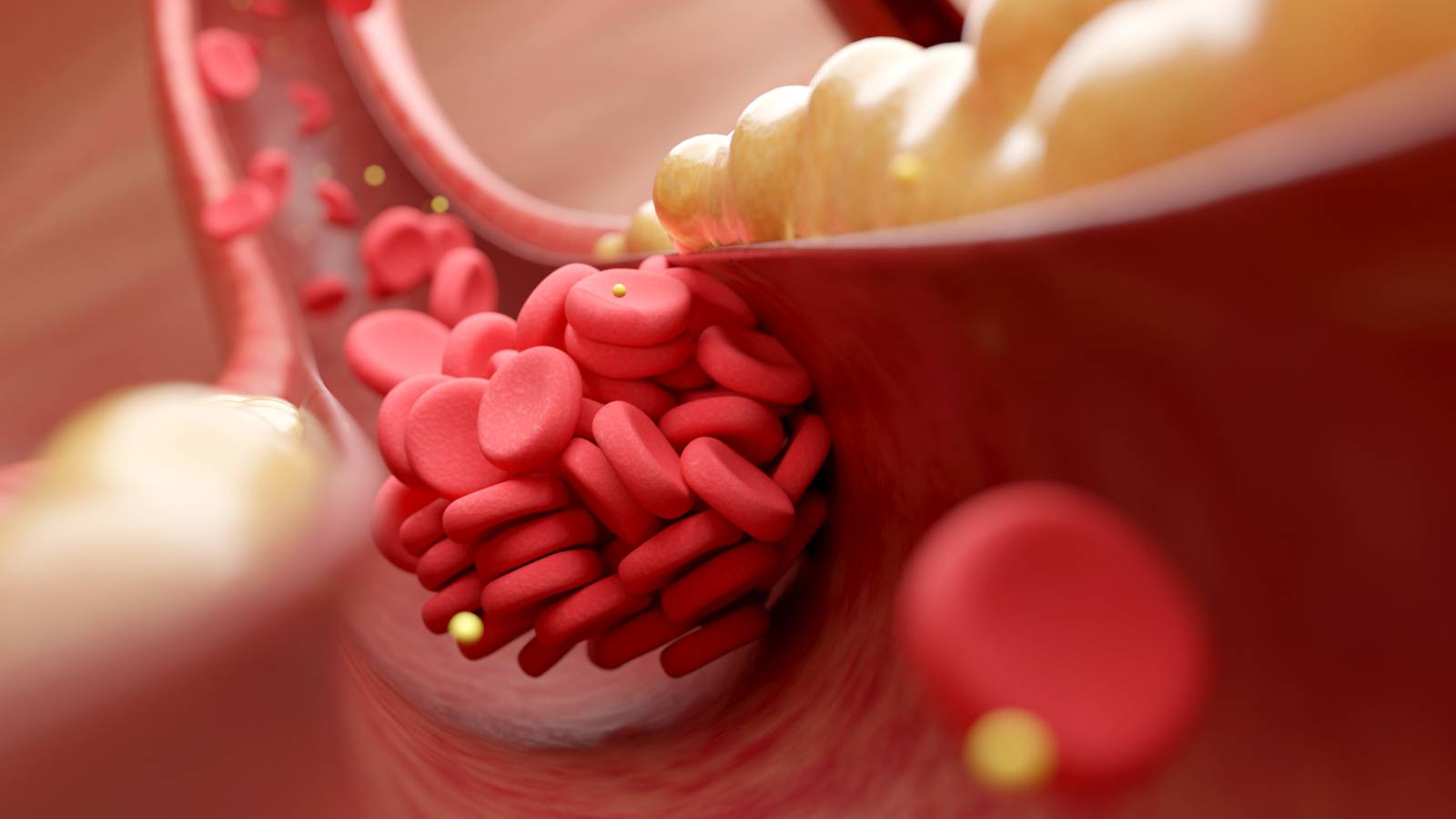 ピルを始めるなら知っておきたい！血栓症リスクが高い人の特徴とリスク対策【専門家が解説】
