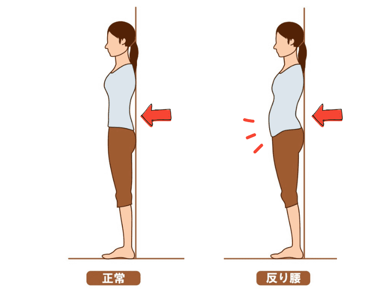 反り腰チェック