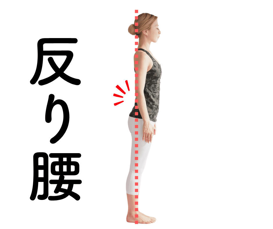 反り腰