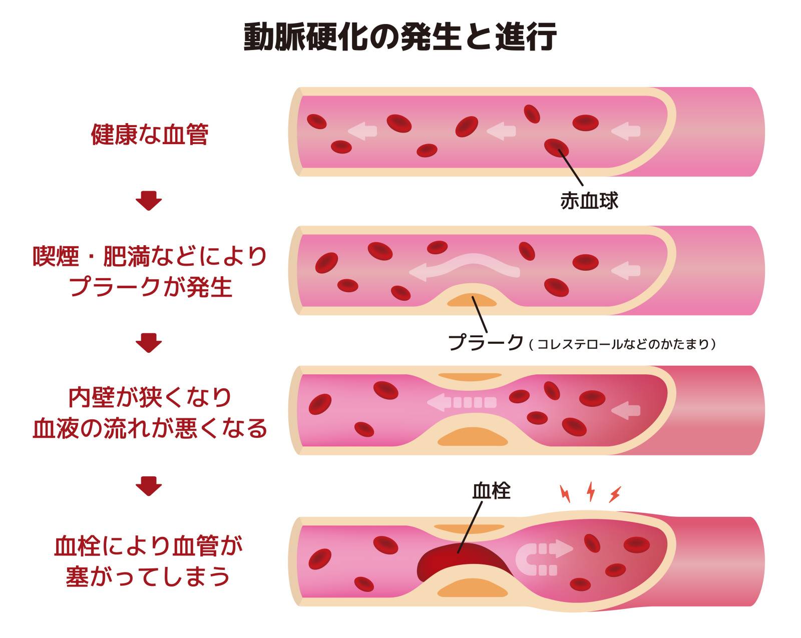 炎症