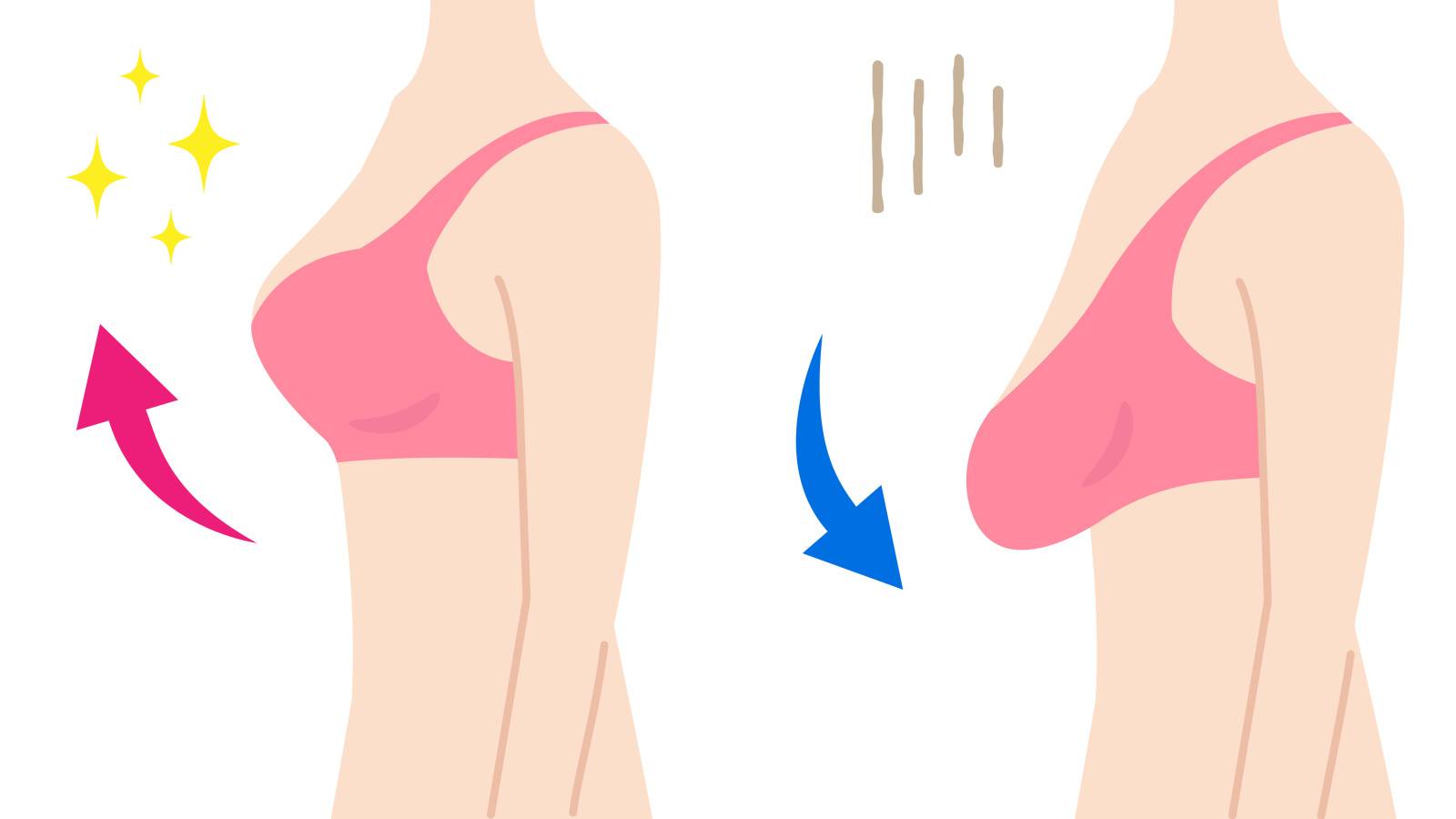 垂れた胸を予防または治療するにはどうすればよいですか?