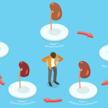 腎不全ステージ