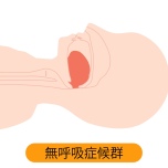 睡眠時無呼吸症候群