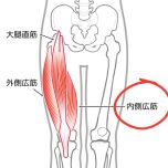 内側広筋