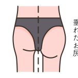 お尻