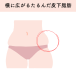 皮下脂肪