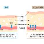 むくみのメカニズム
