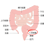 S状結腸