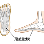 足底筋膜