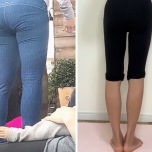 ビフォーアフター