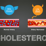 コレステロール
