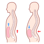 内臓下垂のイメージ