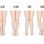 脚の形