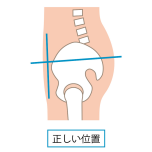 骨盤ニュートラル イラスト