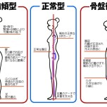 骨盤の歪みについて
