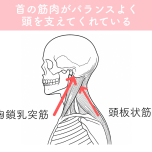 ストレートネック