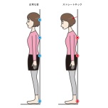 ストレートネックチェック