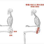 骨盤が後傾している状態