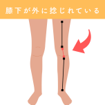 膝下のねじれ