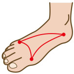 足アーチ