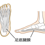 足底腱膜