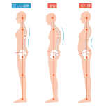 反り腰 猫背 イラスト