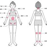 リンパについて