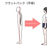 フラットバック