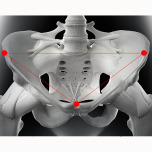 恥骨と上前腸骨棘を結んだ三角ライン