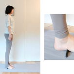 外側アーチケア