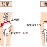 骨盤イラスト